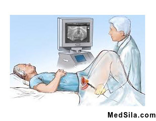 УЗИ простаты