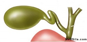 Желчный пузырь